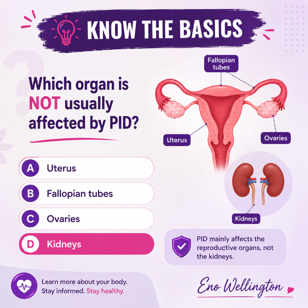 Know the Basics
Which organ is NOT usually affected by Pelvic Inflammatory Disease (PID)?
A. Uteru...