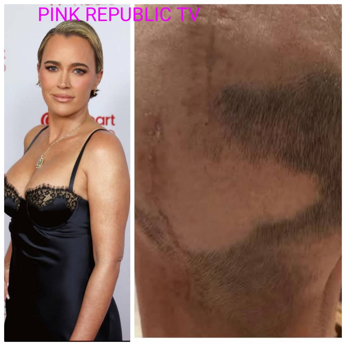 https://pinkrepublic12.blogspot.com/2026/05/teddi-mellencamp-bravely-showcases.html?m=1
