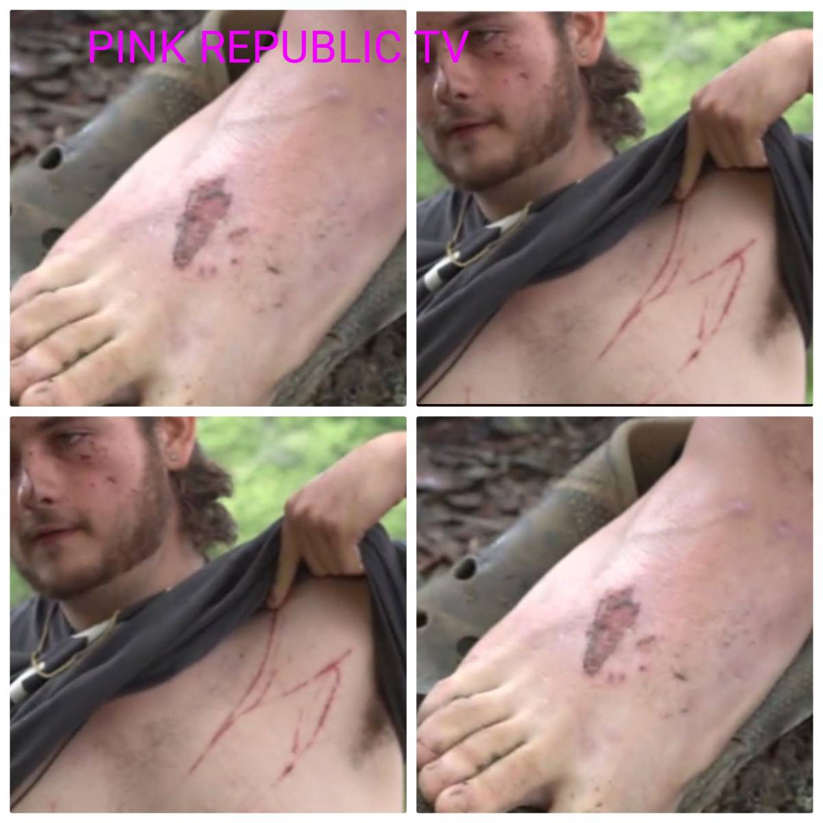 https://pinkrepublic12.blogspot.com/2026/05/a-19-year-old-texas-man-survived.html?m=1