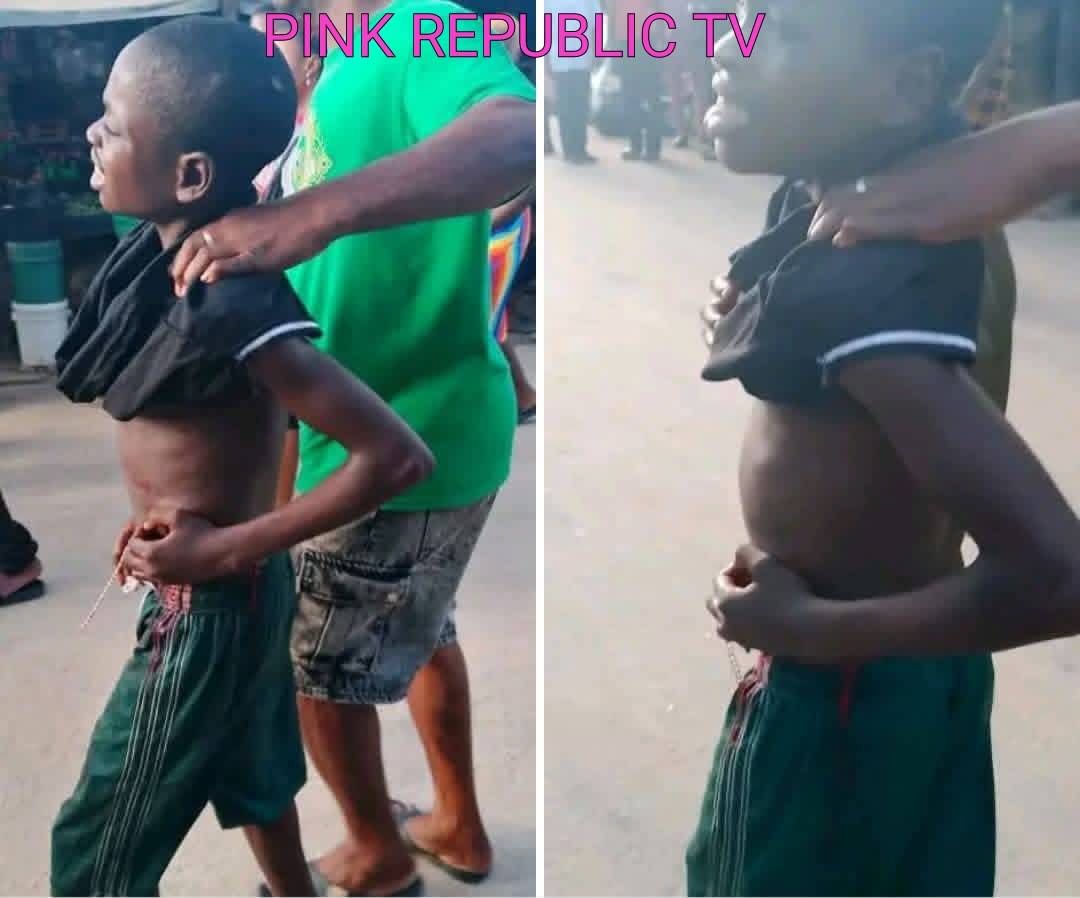 https://pinkrepublic12.blogspot.com/2026/05/mob-attack-erupts-during-national-drug.html?m=1