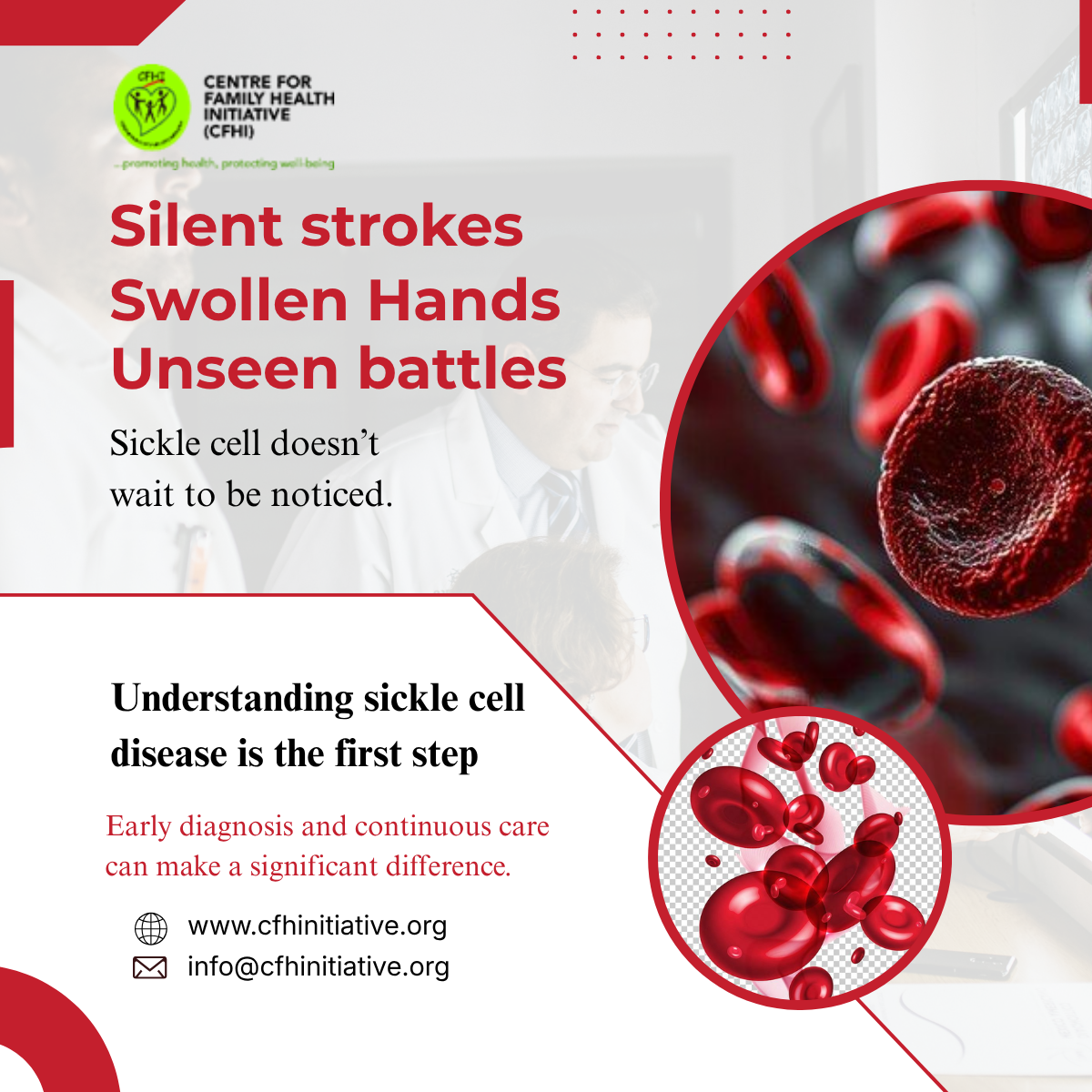Sickle cell disease is a lifelong inherited blood disorder that affects the way red blood cells carr...