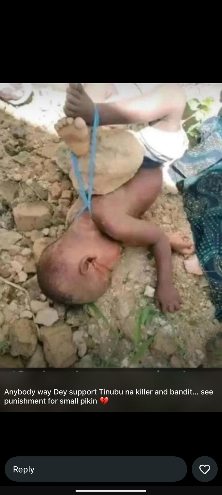 Nigeria is bleeding. Say no to insecurity. Say no to bad government. Say no to killings.