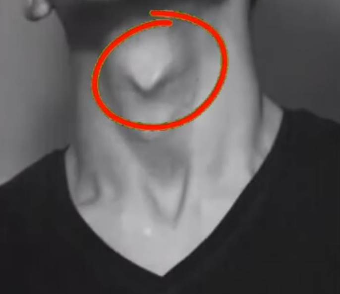 What is this called in English?