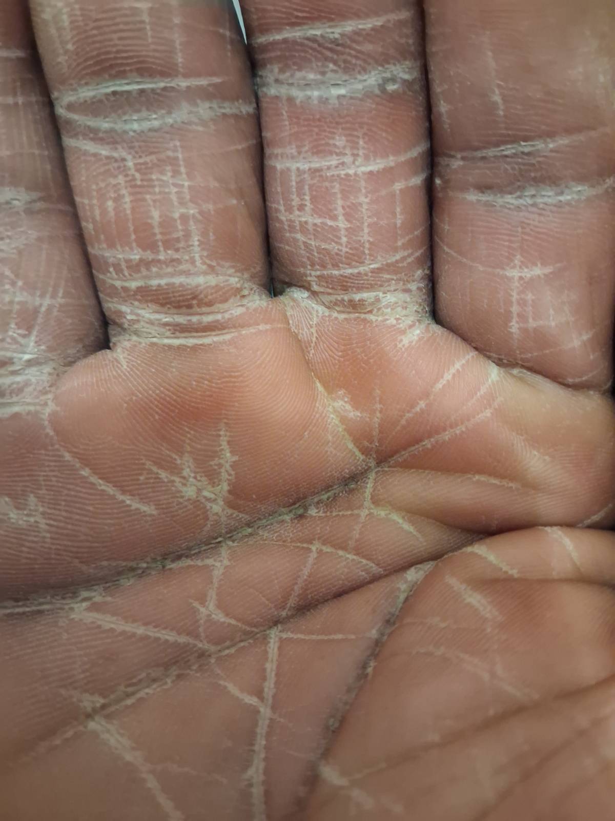 What is ur take on this  palm