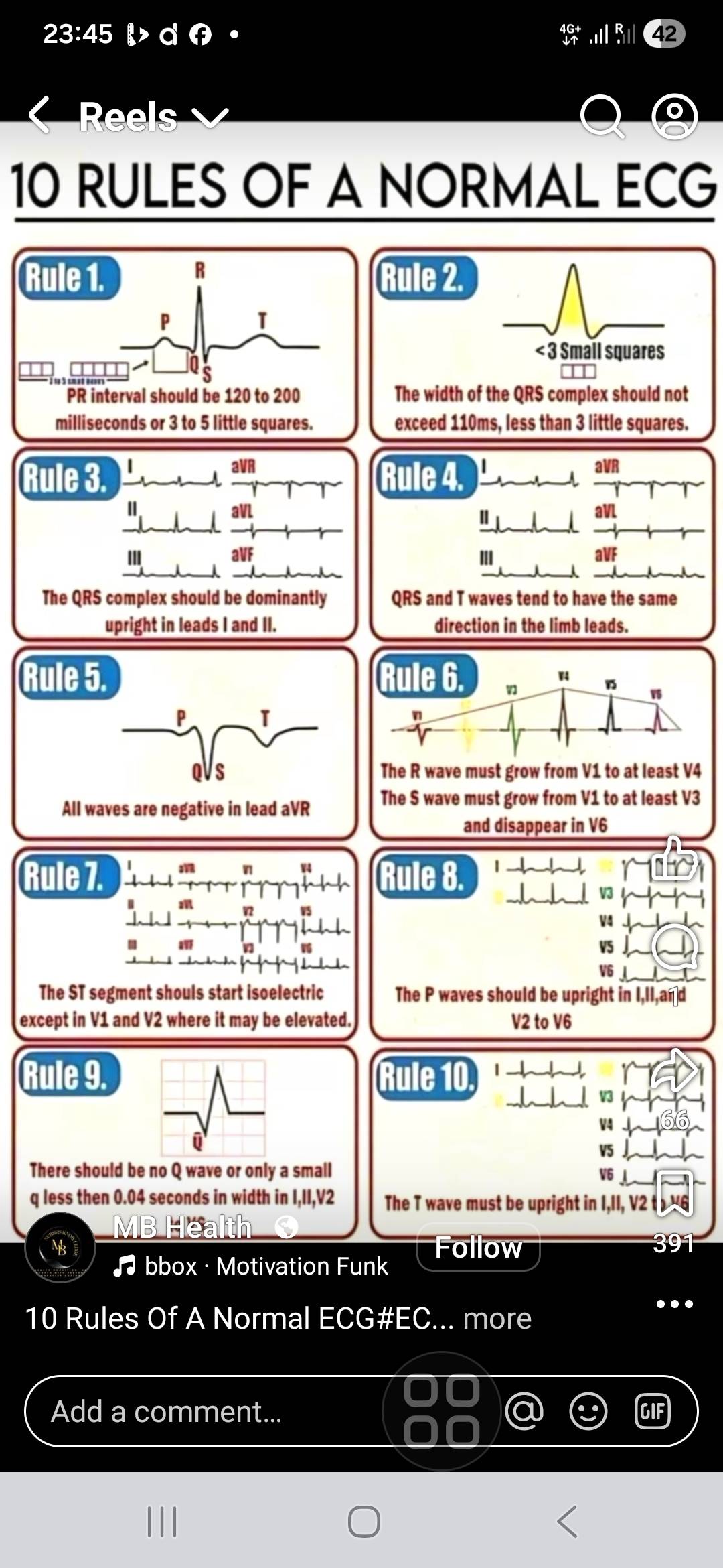 The normal ECG. From several feets above the  ground
