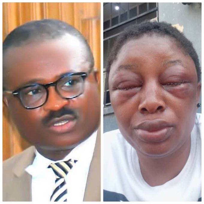 ‘Maybe it’s AI’ – wife of suspended Cross River lawmaker dismisses assault video
