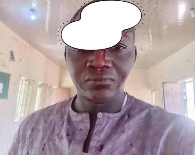 Bauchi radio demands suspension of DPO over assault on reporter