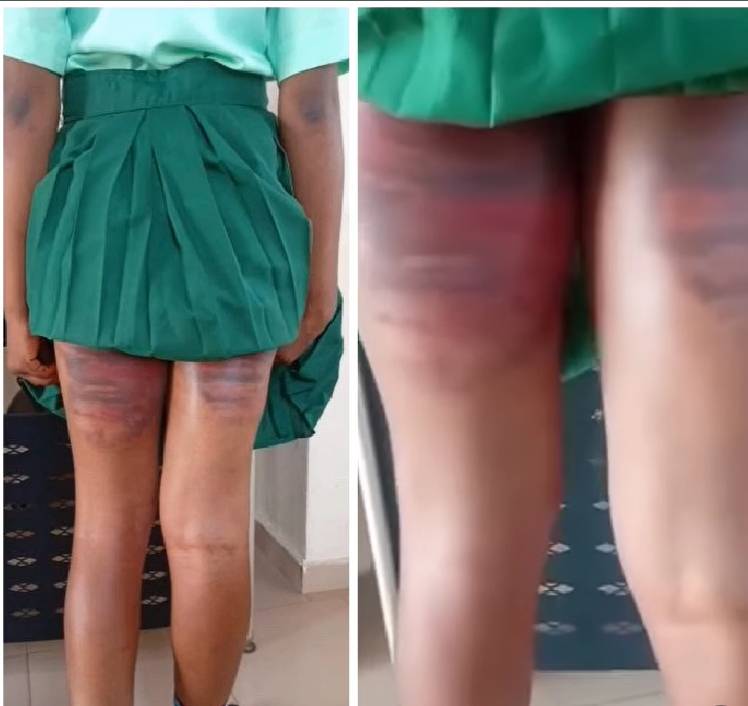 Concerned individuals are calling for urgent intervention following allegations that an SS3 student,...