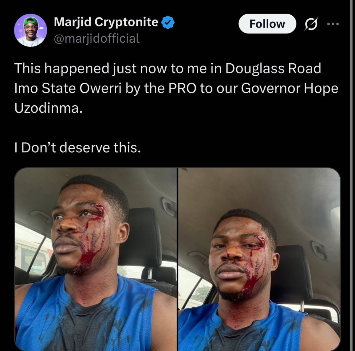 Crypto Influencer Marjid
Cryptonite Claims Assault by Imo State Governor's PRO