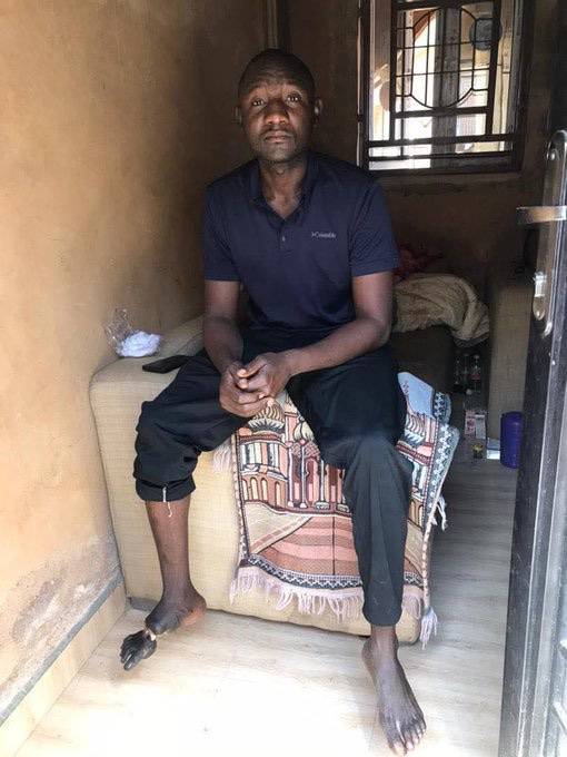 Picture of this injured Nigerian soldier sparks outage online 💔