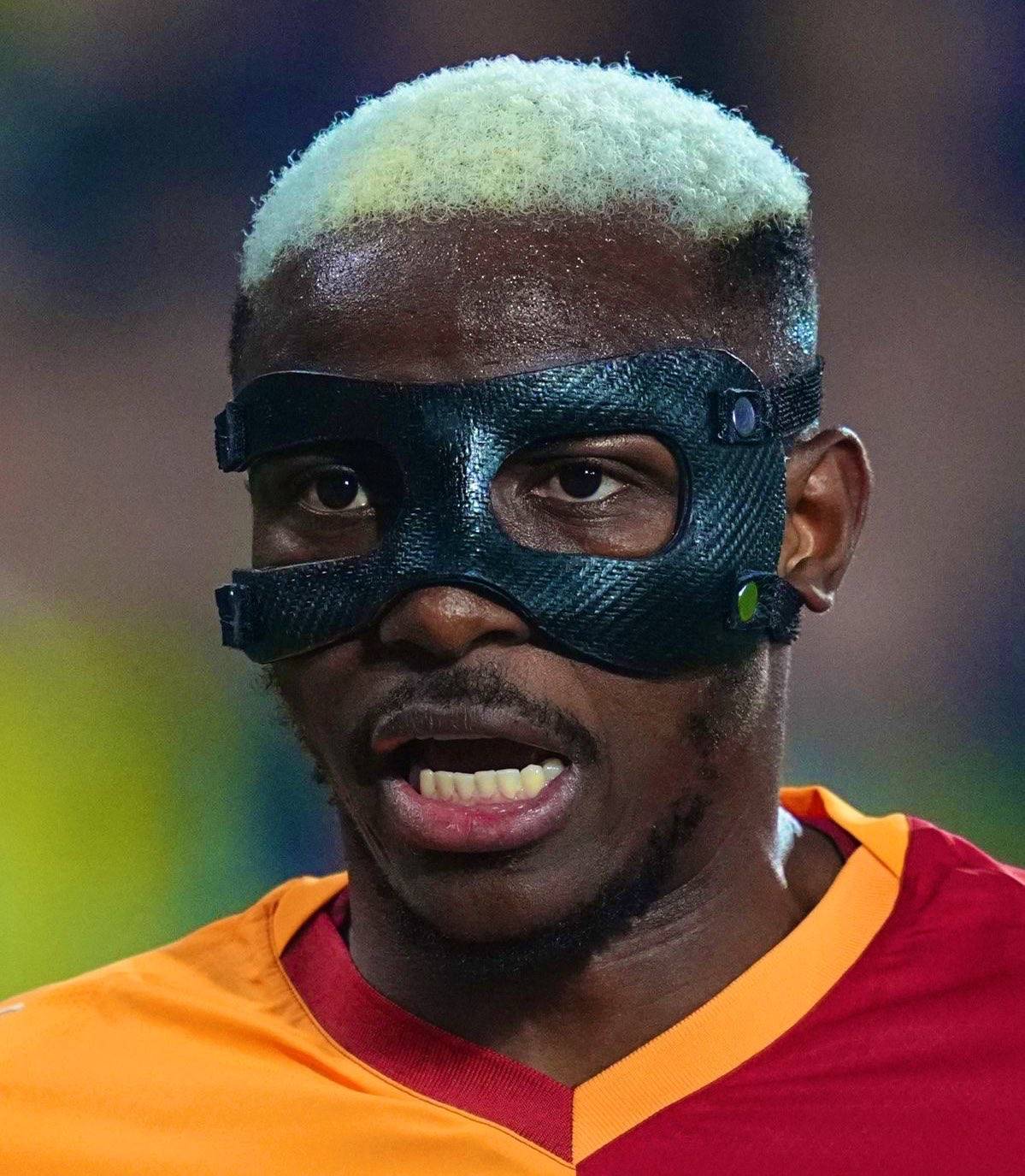 I can't eat with the right side of my face. There are 18 screws there
~ Nigerian Footballer Victor...