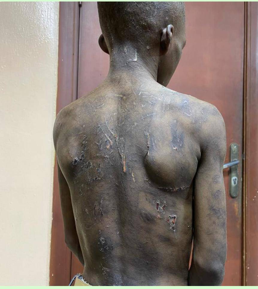 This is boy can't be his son. No mother would treat his son savagely like this. Thank God the law ca...