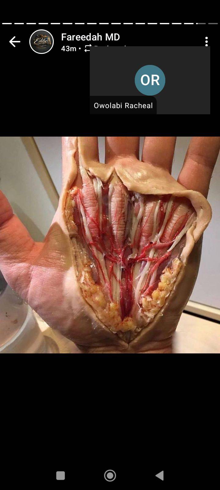 The anatomy of the hand (deep to the skin). What a wonderful thing, yeah? Now, imagine the chest and...