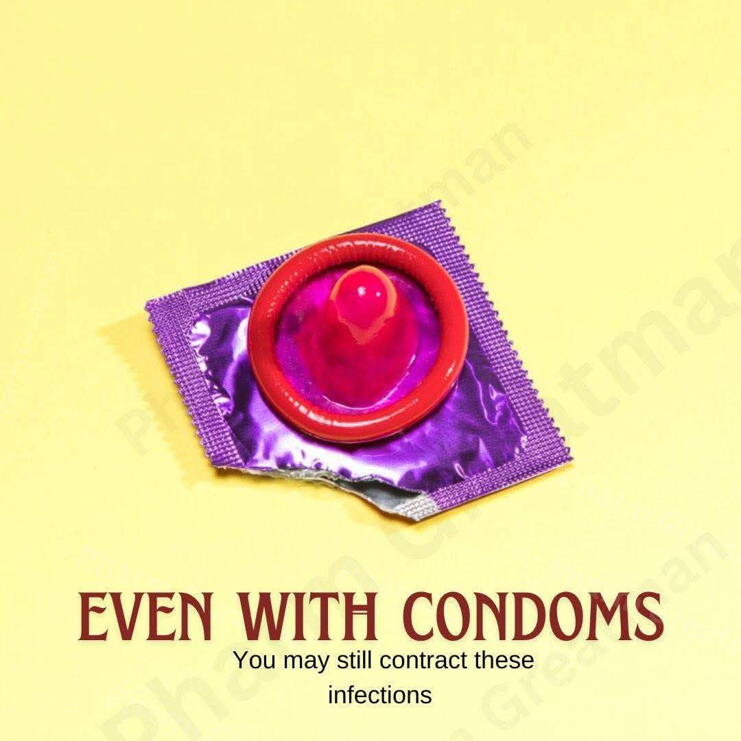 Even with condoms, you may still contract
1. Human papillomavirus (HPV)
Spreads through skin con...