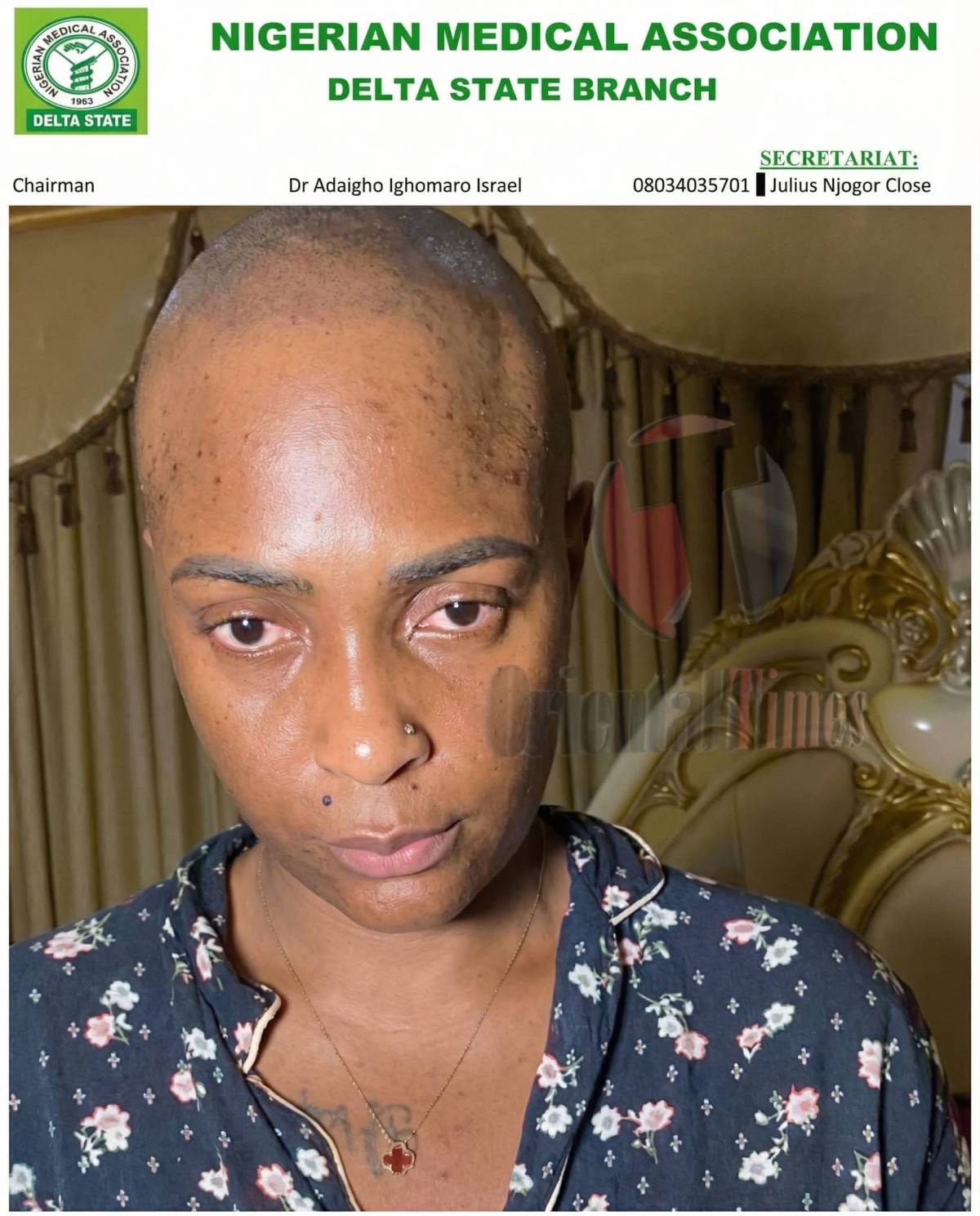 JUST IN: Nigerian Medical Association Confirms Notorious Clout Chaser, Blessing CEO Doctored And Par...