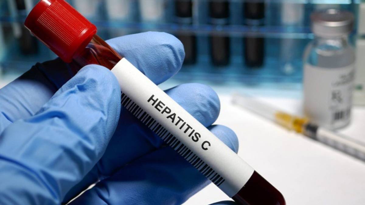 Hepatitis C (HCV) is a blood-borne virus that silently damages the liver in many people. Unlike hepa...