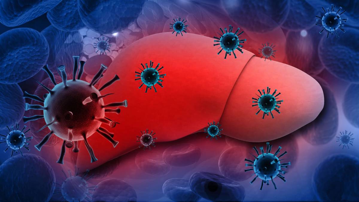 Viral hepatitis, particularly Hepatitis B (HBV) and Hepatitis C (HCV) is a major, but often hidden,...