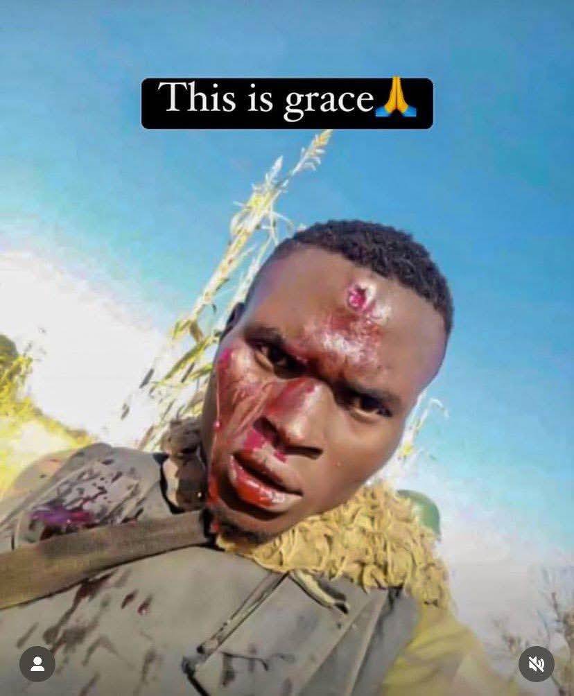 THIS IS TRULY GRACE
It is medically impossible to survive a 7.62mm round from an AK-47 to the head,...