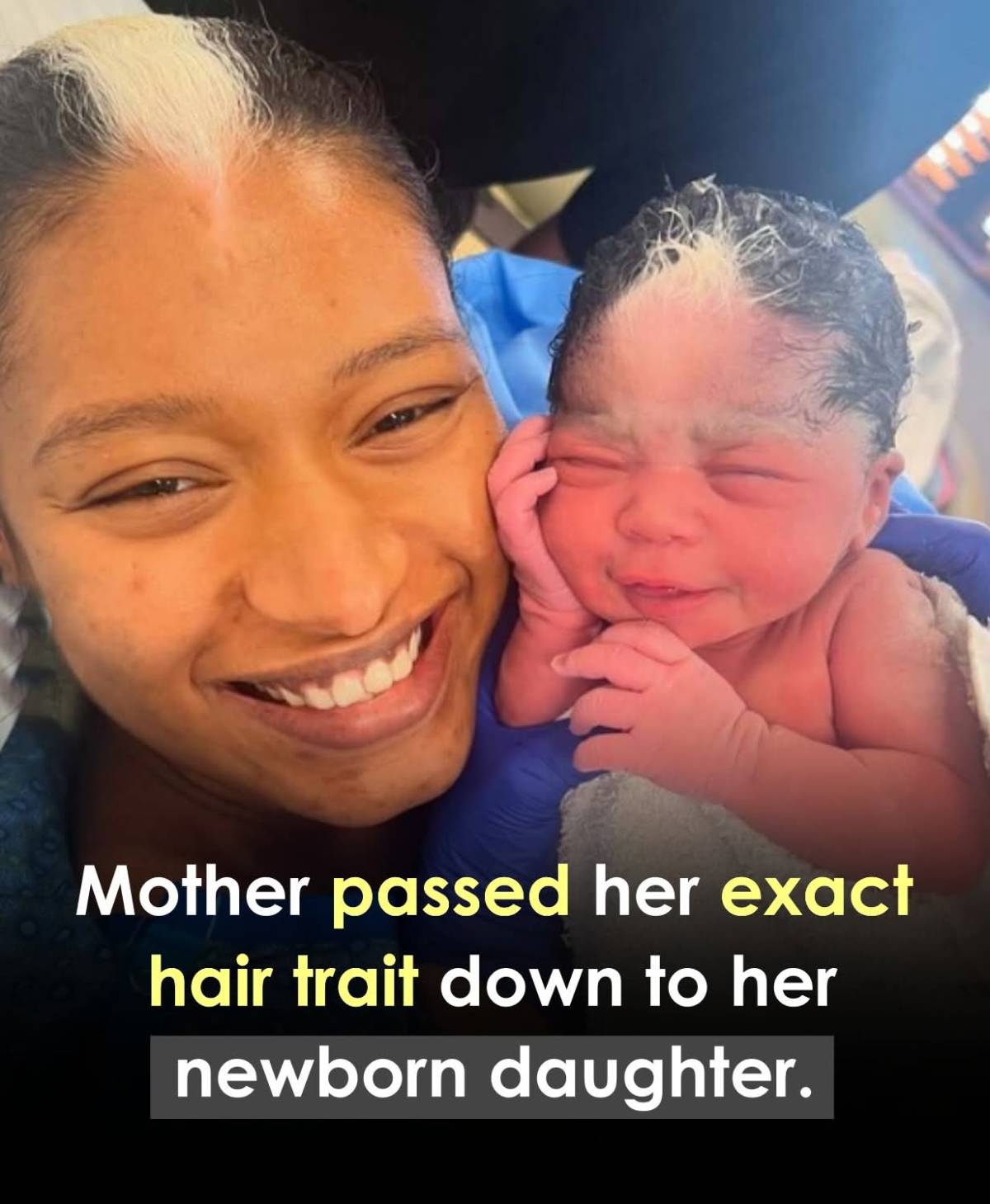 ๐ฉโ๐งโจ A mother is going viral after her newborn daughter was born with the exact same rare hair tr...