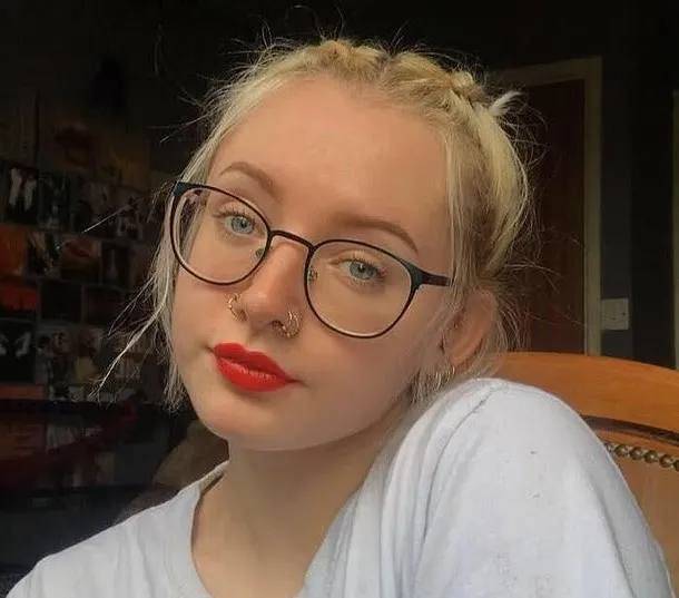23-Year-Old Woman D+es from Vomiting and Hallucinations After Taking Paracetamol for Toothache