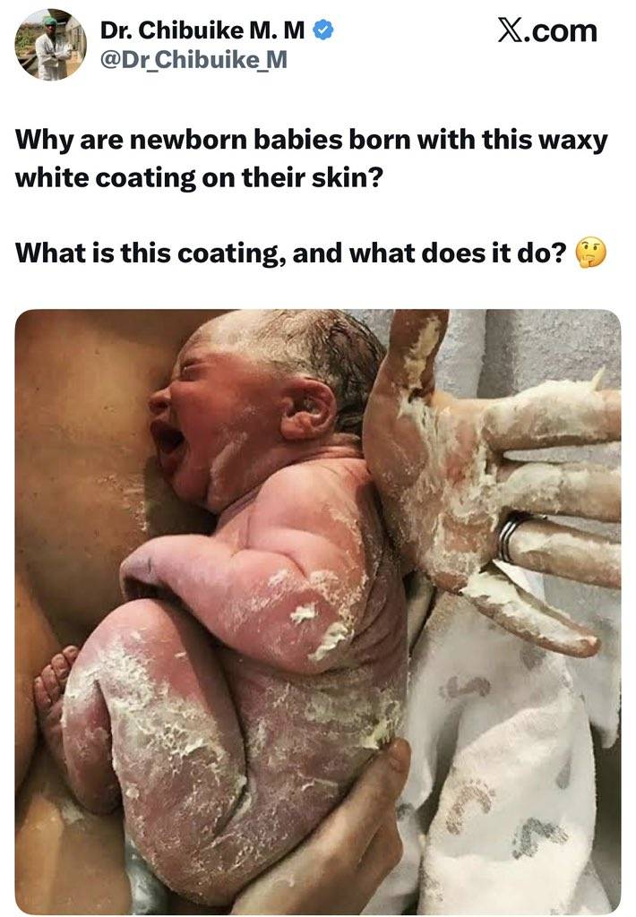Why are newborn babies born with this waxy white coating on their skin? — Dental surgeon Chibuike qu...