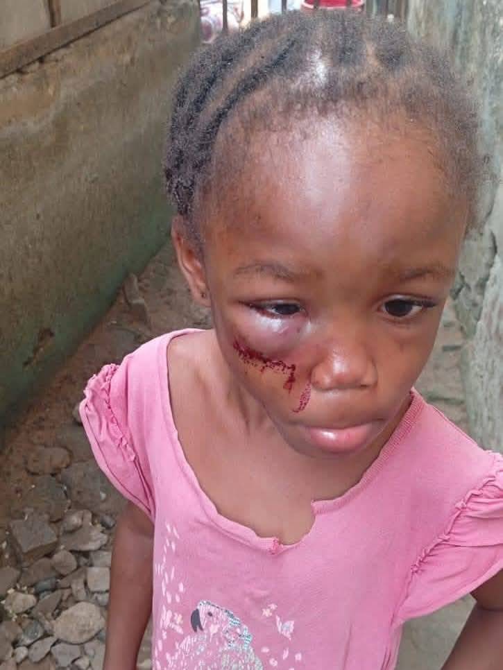 BREAKING NEWS: One Mrs Unyime Bassey of number 8 stream road off Atimbo Calabar Municipality, beat t...