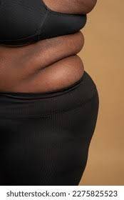 When did honesty become offensive?
I used the word “fat” to describe what was obvious—and somehow th...