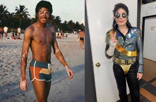 I really grew up thinking Michael Jackson bleached his skin because he “didn’t want to be Black”… wh...