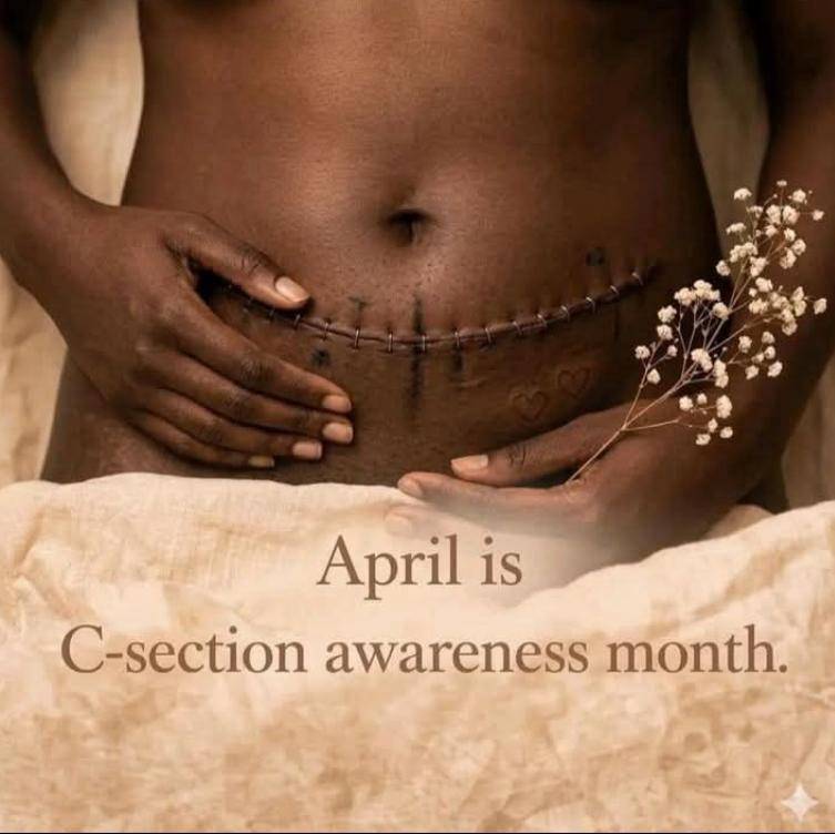 All the beautiful mothers in the theater right now I pray for a successful C-section in Jesus name a...