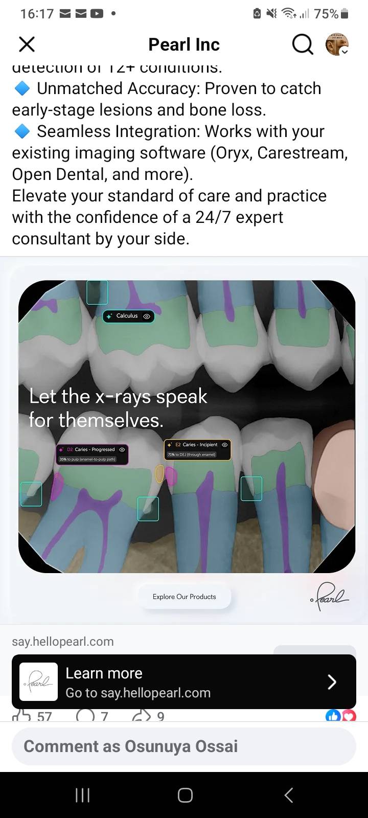 Post by Dr. Godwin Ossai, DDS