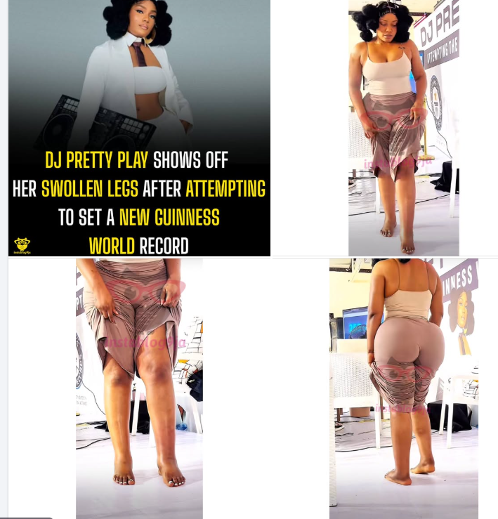 DJ Pretty Play shows off her swollen legs after attempting to set a new Guinness World Record #daily...