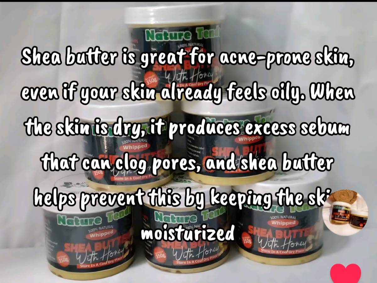 #6700 for 350g
WhatsApp 08063198587 to place order.
Worldwide delivery.
#sheabutter #natureten...