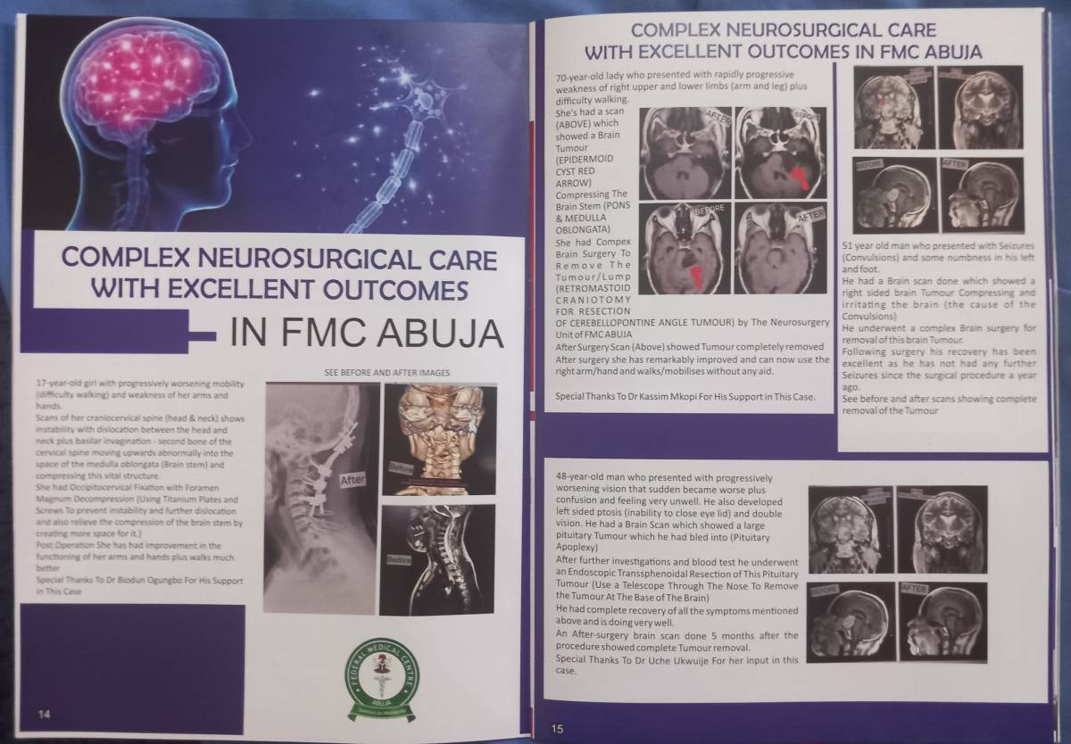 Complex Neurosurgical Care in FMC Abuja With Excellent Outcomes
#thenigerianpatientsareworthit