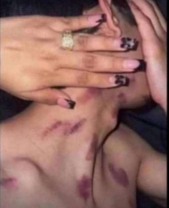 They call this love bite, but why dem nor dey bite the girl?