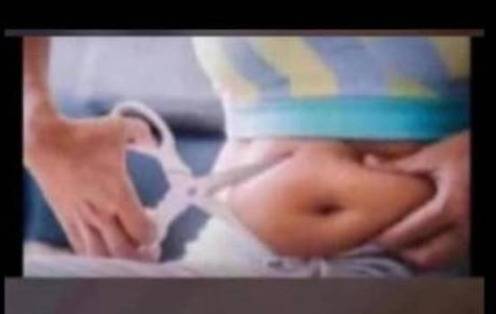 Only me go do this surgery myself, no time.😫😂