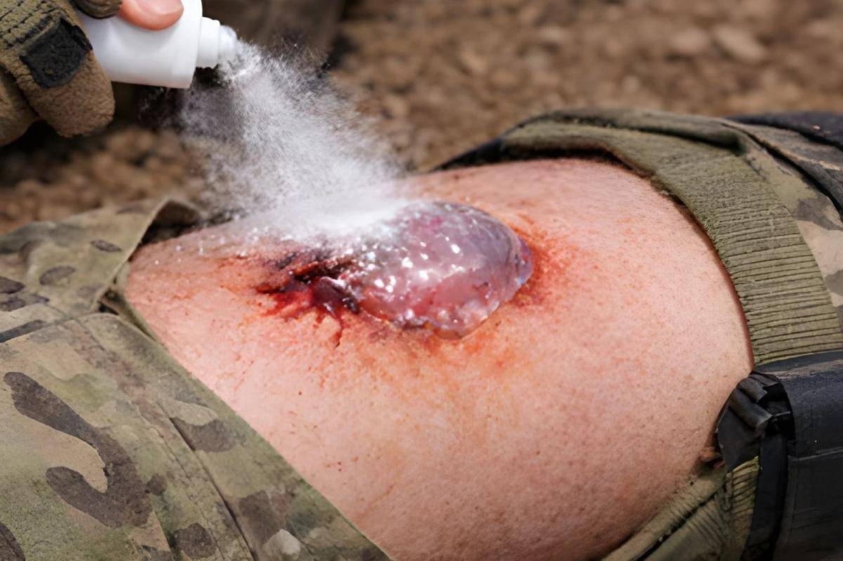 South Korean scientists create life-saving spray to instantly stop bleeding.