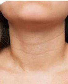 What you should do when you are 30years+
Use more of hydrating ingredients like hyaluronic acid an...