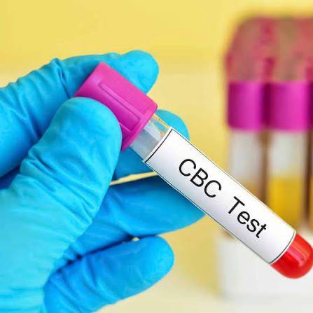Medical Tests & What They Check:
🩸CBC — Anaemi, infection
🧪Blood Glucose — Diabetes
🧫LFT — Liver...