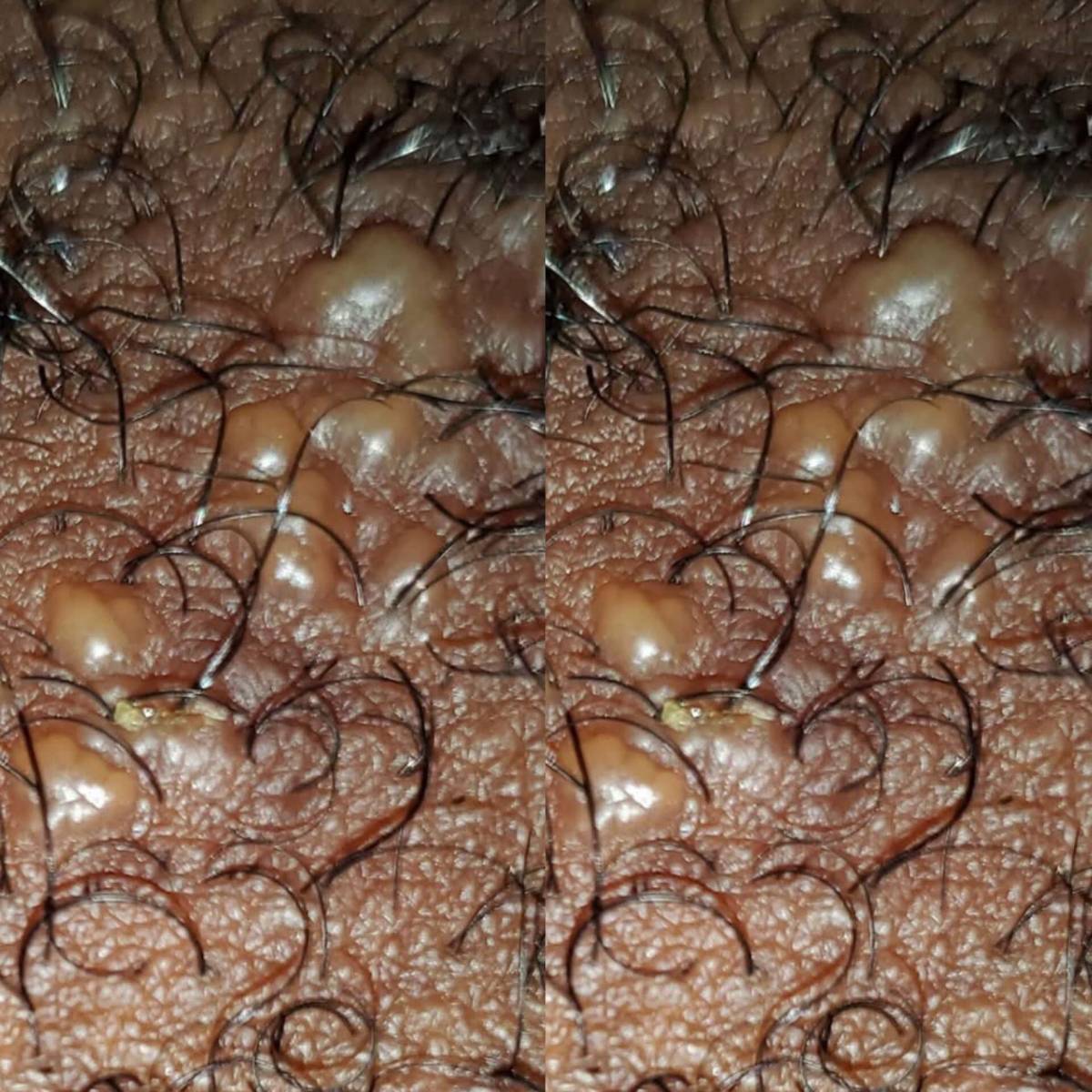 What causes this and any prevention or cure?
