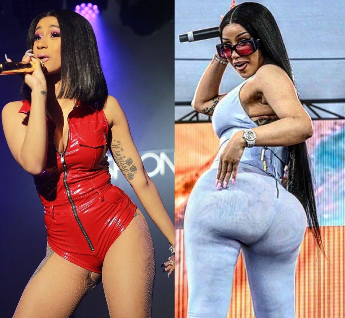 Cardi B Says She’s Heading to Colombia to Remove Her Butt Implants After Her Tour 🫣😭