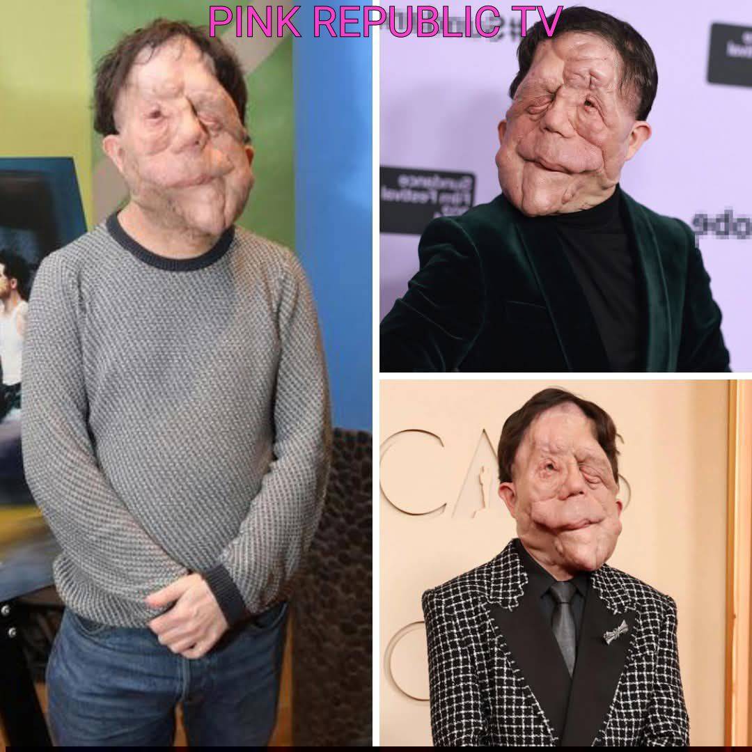 https://pinkrepublic12.blogspot.com/2026/03/adam-pearson-claps-back-at-comedian-who.html?m=1
