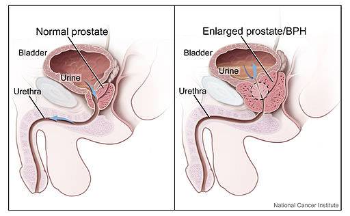 Men and PSA: What You Should Know
Prostate health is something many men don’t talk about—but it’s s...