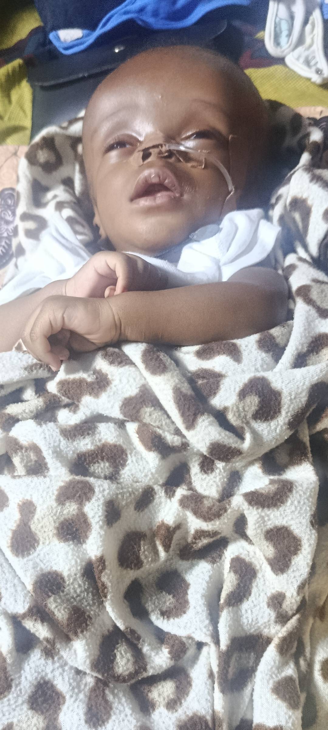 Please pray ๐ for my three months old Son Gabriel Chidubem
He is battling with Hydrocephalus
Or be...