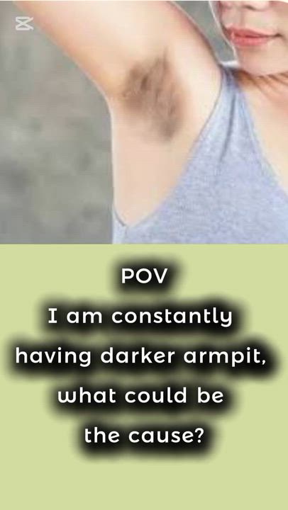 Want to know what causes dark underarm?
Here it is

Pls follow me for more skincare tips