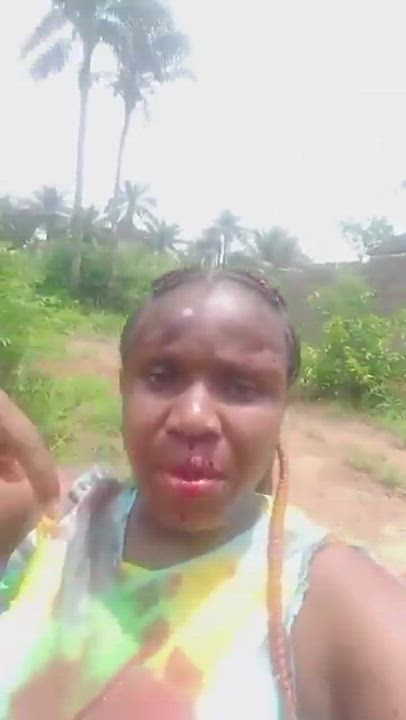 “I am married to a beast. This is what my husband did to me... he wants to kill me”  

~Woman cries...