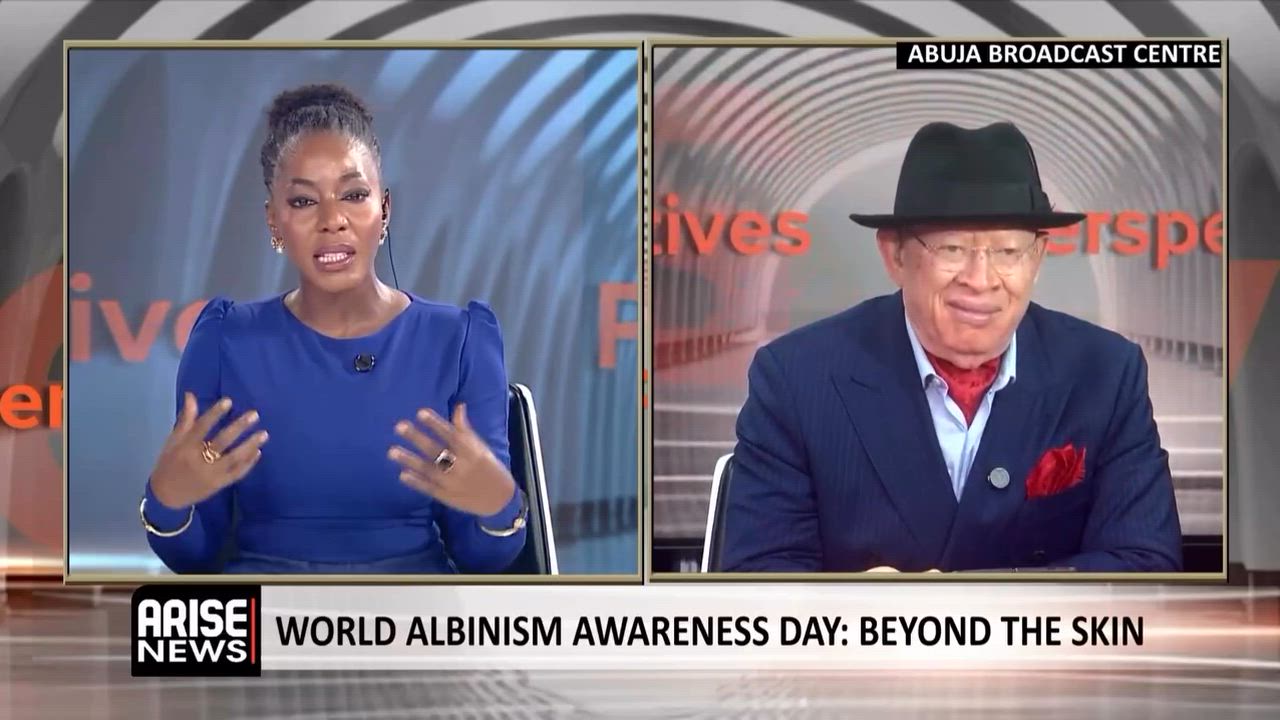 Today, we recognize the experiences of persons with albinism and the challenges many face, including...