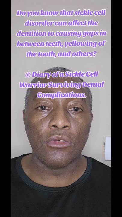 Do you know that sickle cell disorder can affect the dentition to causing gaps in between teeth, yel...